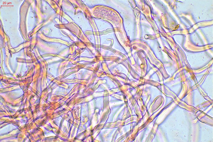 hyphes de la trame lamellaire à paroi épaisse, parfois solidifiée