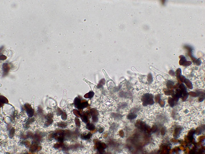cheilocystides
