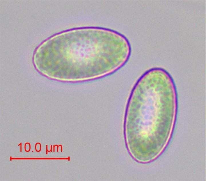 Peziza arvernensis. Fouad Ouchène