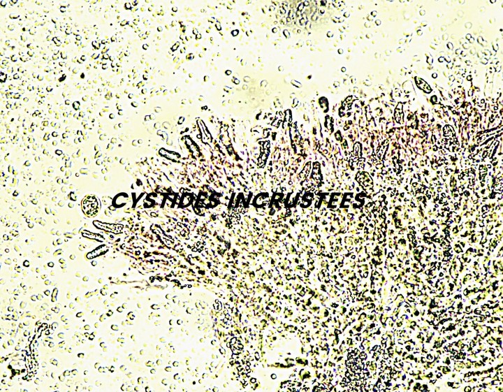 Cystides incrustées..jpg