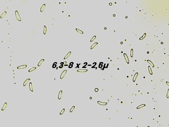 Sp 6,3-8 x 2-2,6 µ.jpg