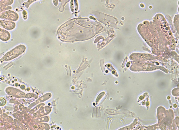 SPORES 9 x 3,2µ.jpg