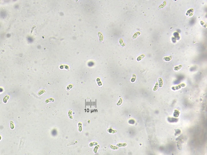 spores_x400_01.jpg