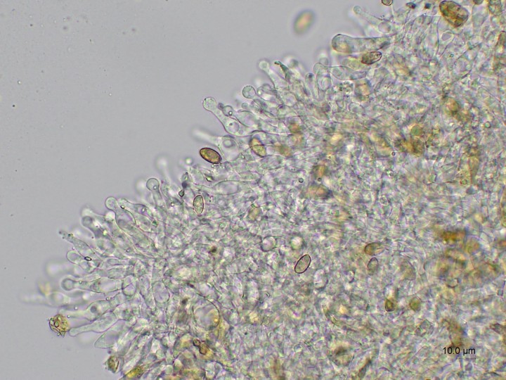 Cheilocystides