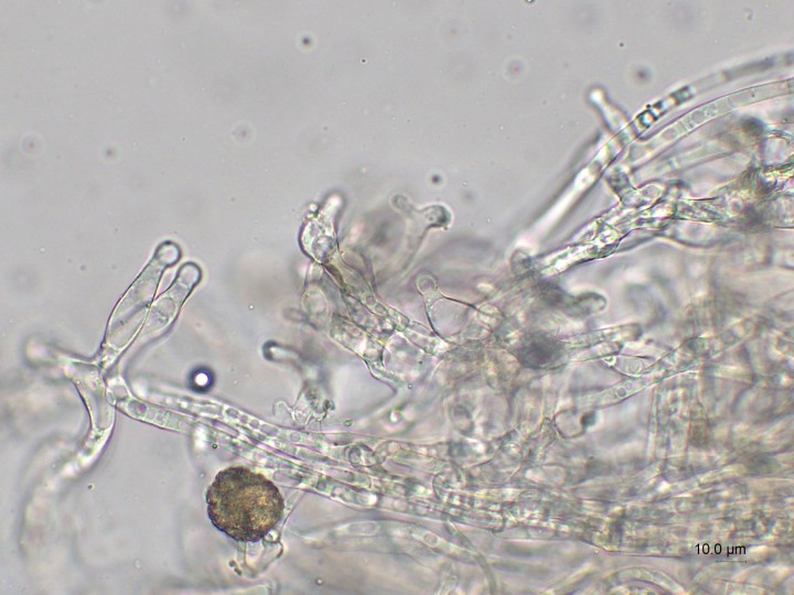Caulocystides