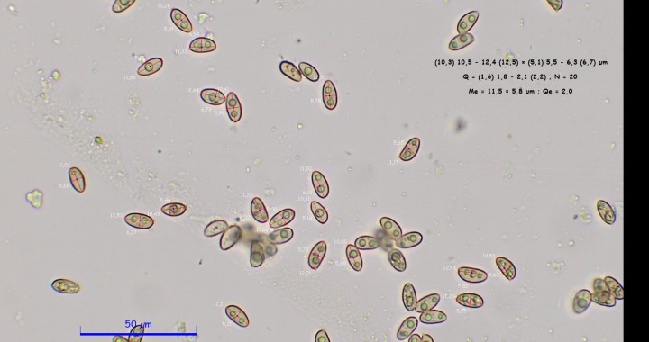 Spores x 400