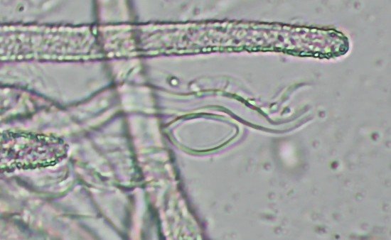 Spore