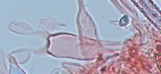 Baside 2-sporique
