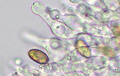 cheilocystides.jpg