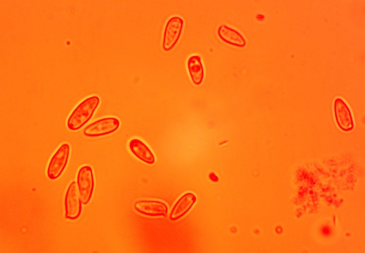 Lepiota spores.jpg