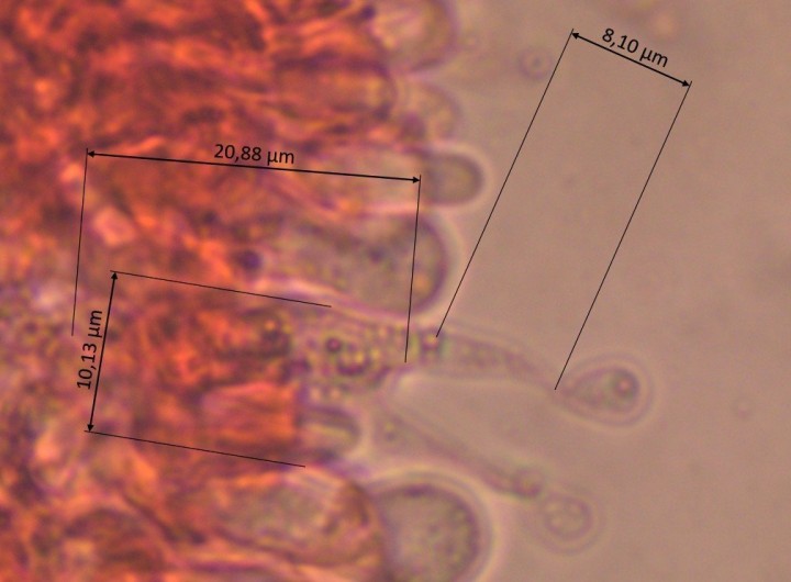 Baside 2-sporique