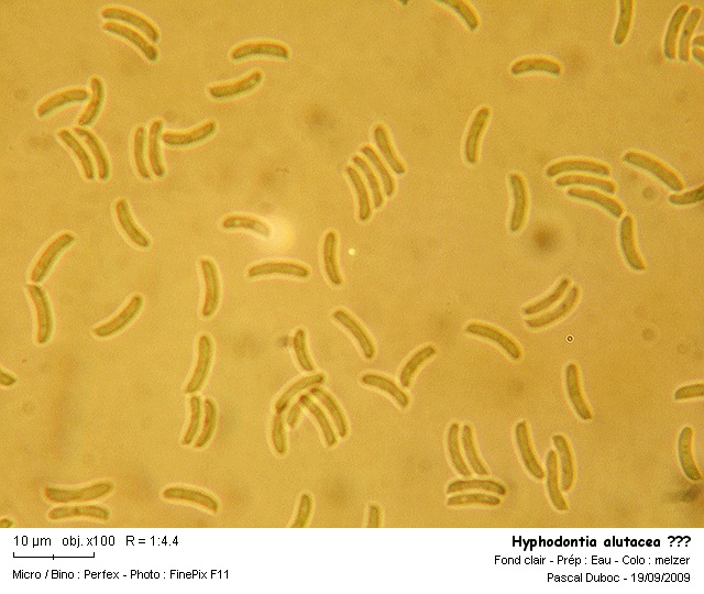 hyphodontia_alutacea_.jpg
