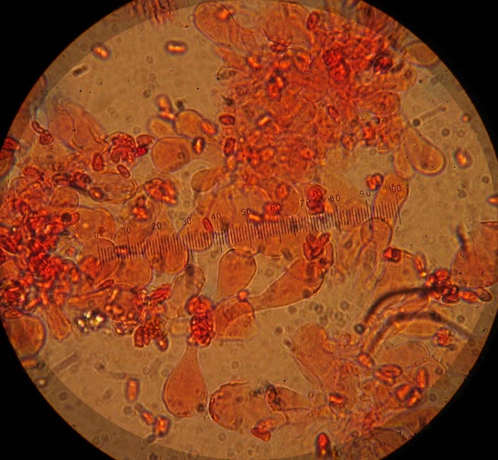 Cheilocystides Lepiota-cristata v-pallidor.JPG