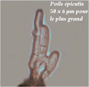 poils épicutis lactaire.jpg