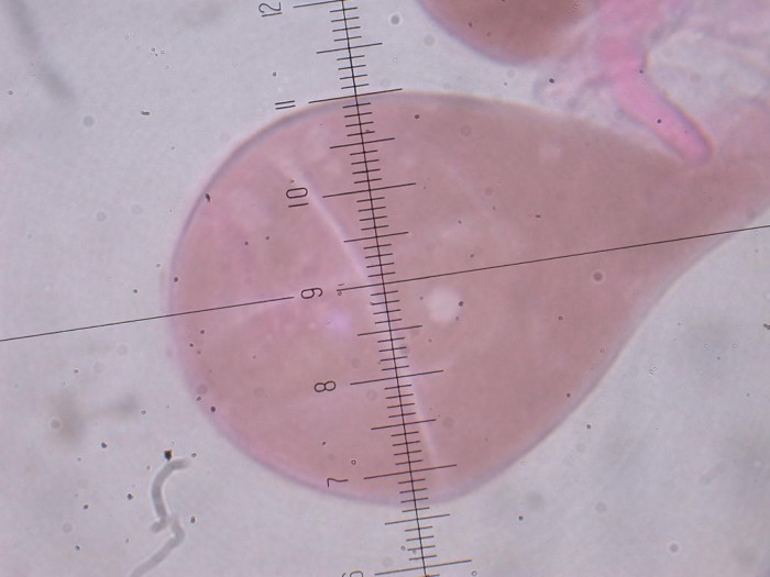 Cellules cuticulaires