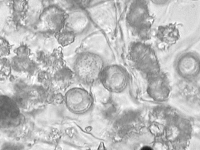 spores