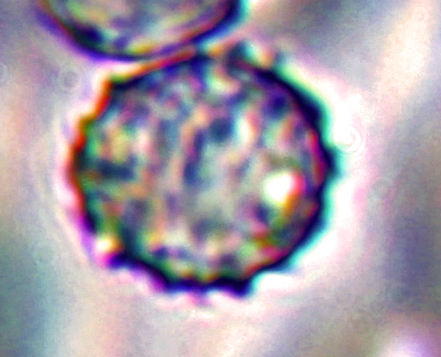Photo très contrastée d'une spore