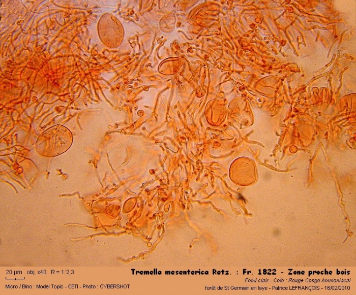 tremella_mesenterica_retz__fr_1822_-_zone_proche_bois.jpg