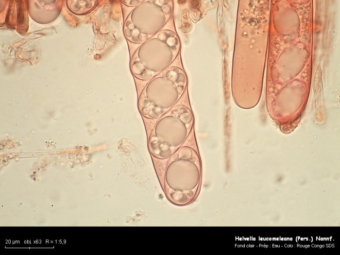 Helvella leucomelaena, ascospores, x63 2.jpg