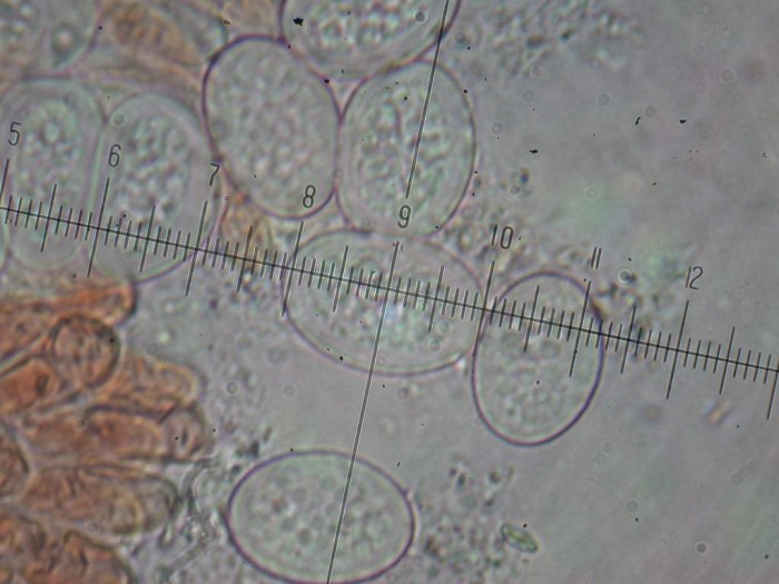 Scutellinia scutellata  X1000  France FIFI GILLY 30 avril 2010 068.jpg