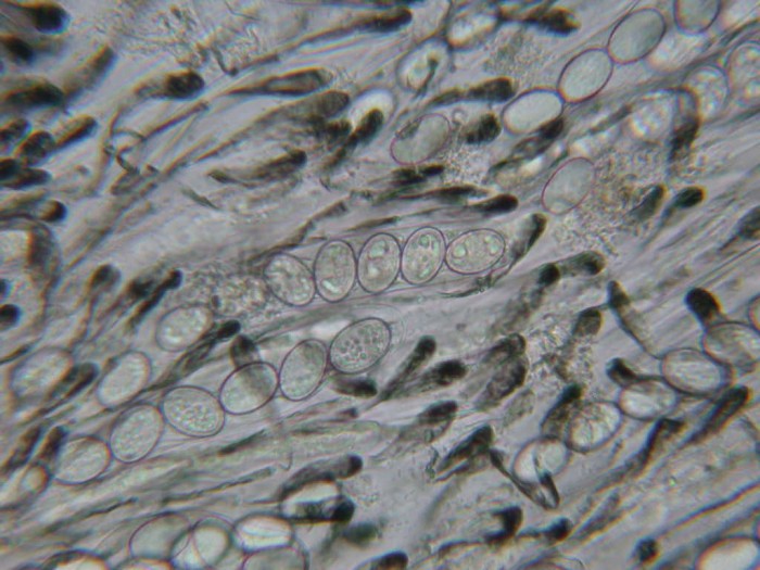 Scutellinia scutellata  MELZER negatif  France FIFI GILLY 30 avril 2010 082.jpg