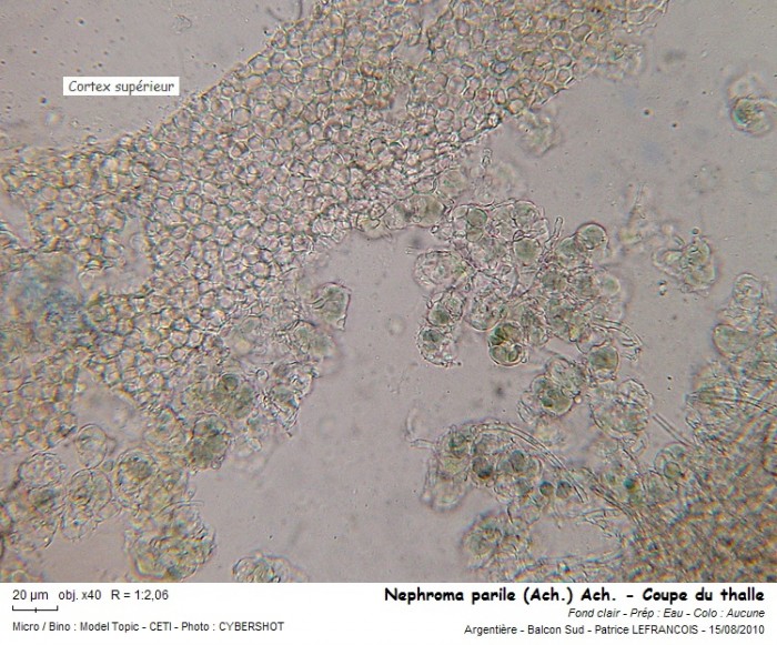 nephroma_parile_ach_ach_-_coupe_du_thalle.jpg