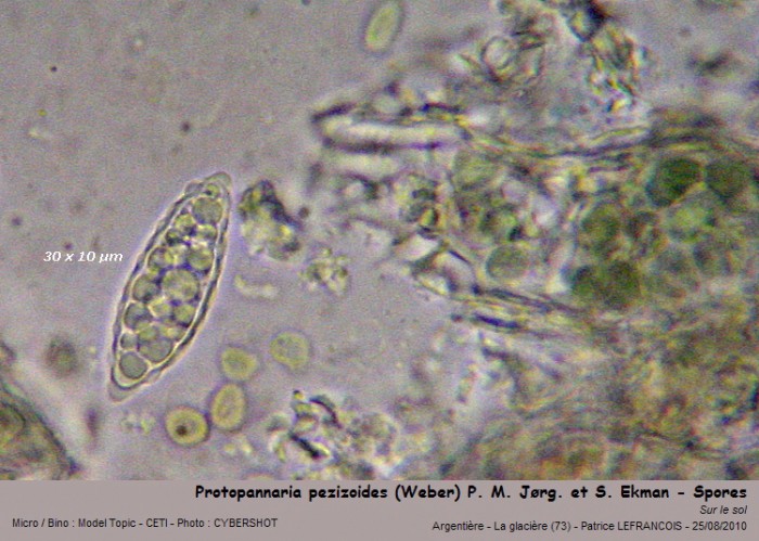 protopannaria_pezizoides_spores.jpg