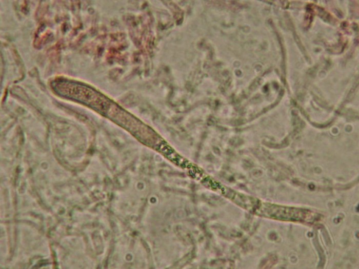 Dermatocystides CUTIS