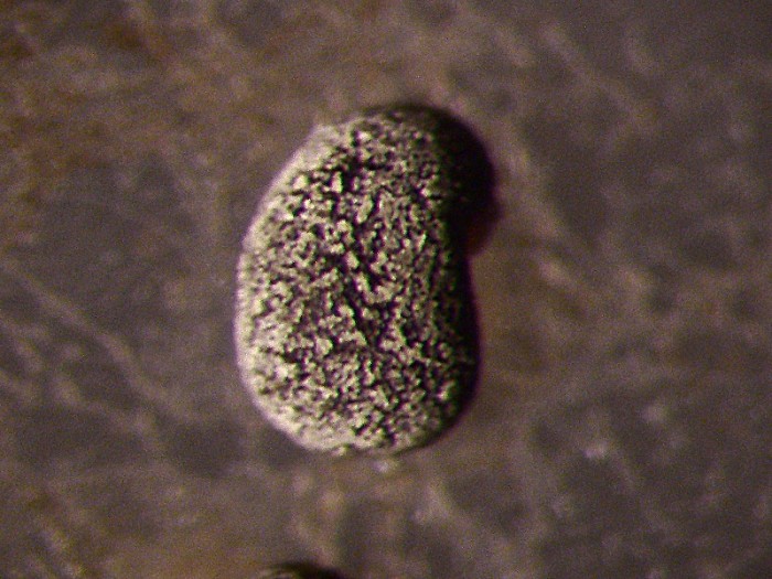 myxomycète-sporange_11110c (1).JPG