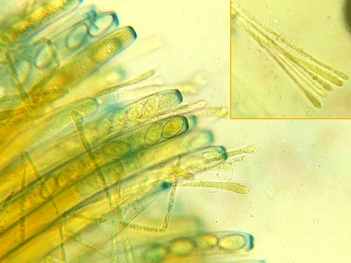 paraphyse.jpg