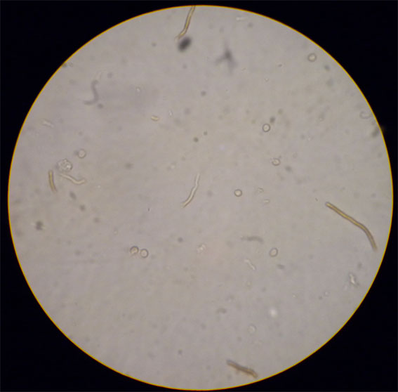 spores.jpg