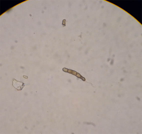 spore Pyrenula.jpg