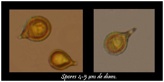 Spores lycoperdon sp 2.jpg