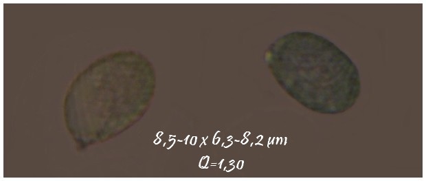 Spores Amanita sp.jpg