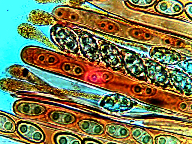 paraphyses,asques et spores.bm 2p (640x480).jpg