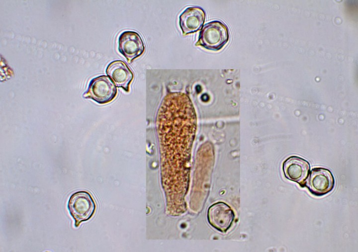 Spores &amp; Basides (photo)