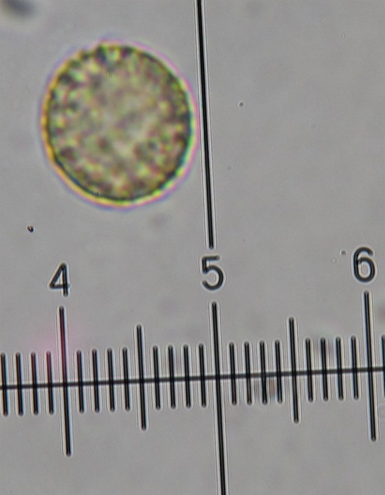 spore Trichia.jpg