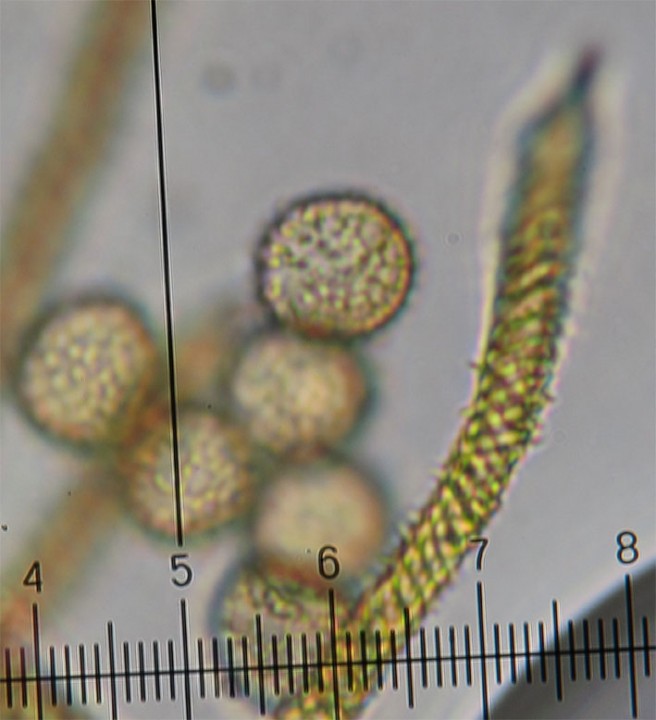 spores Trichia 2.jpg