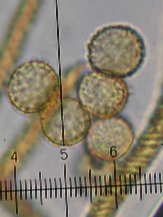 spores Trichia 4.jpg