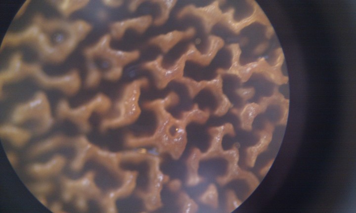 tube  vus sous loupe