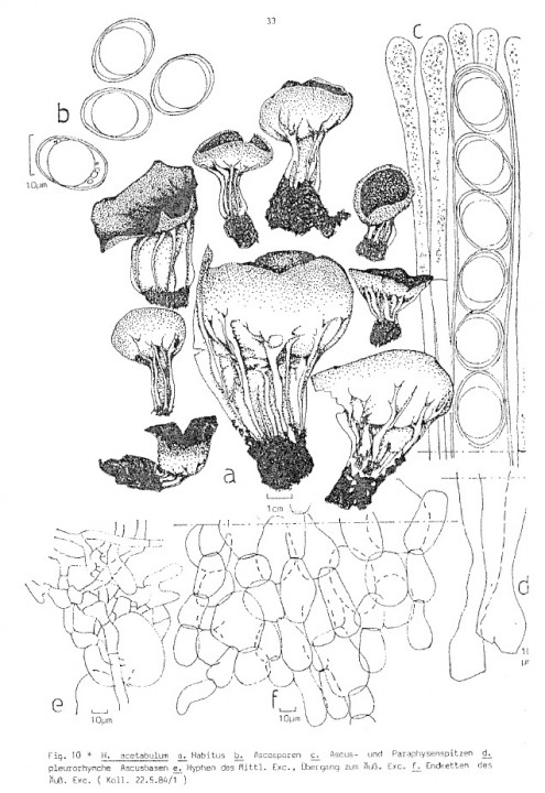 pl acetabulum haffner.jpg