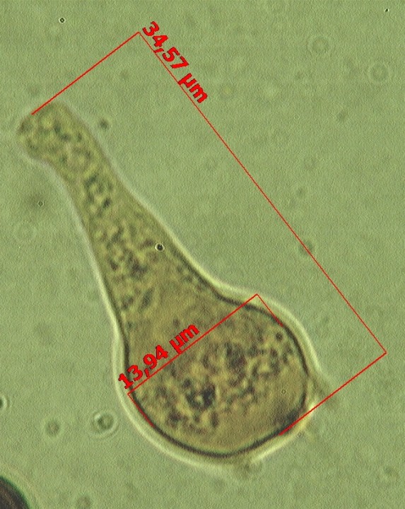 B. 100 X.jpg