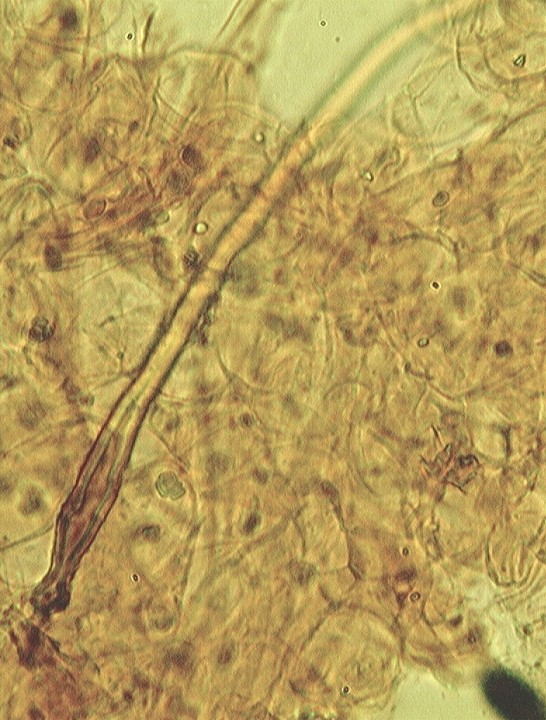 Poil dans cuti , chair formée de cellule ronde