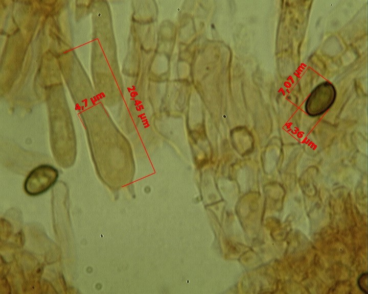Agaricus 100 X 1.jpg