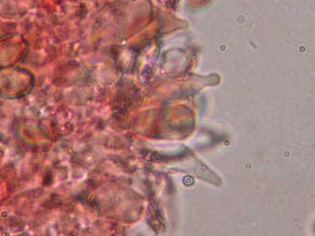 Cheiloscystides