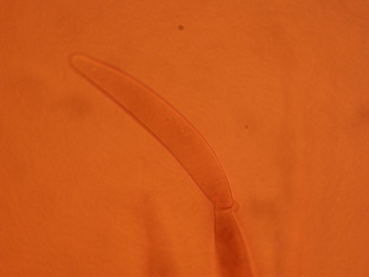 Hyphe de la cuticule