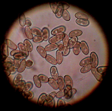 Spores Inocybe.jpg