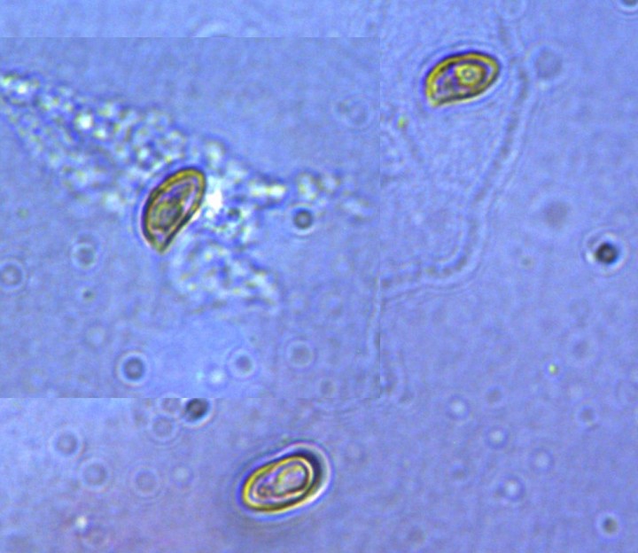 spores.jpg