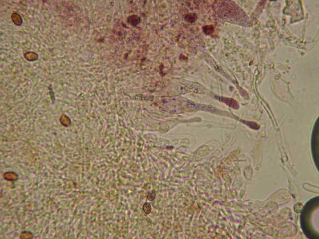 Caulocystides