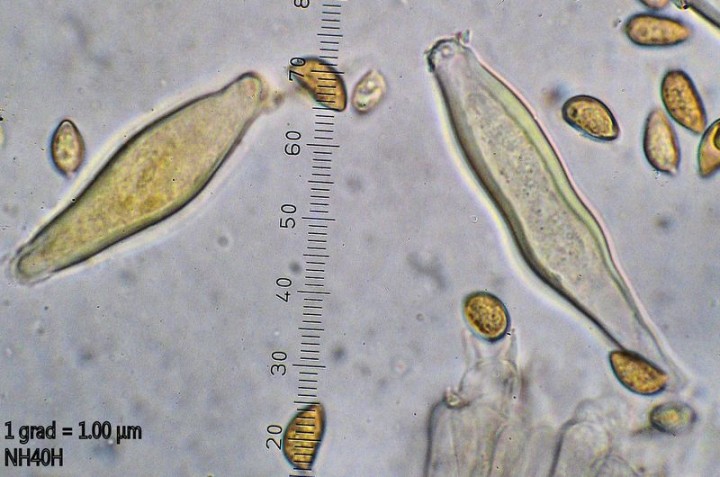 Cf Aurivenia cystides détail.JPG